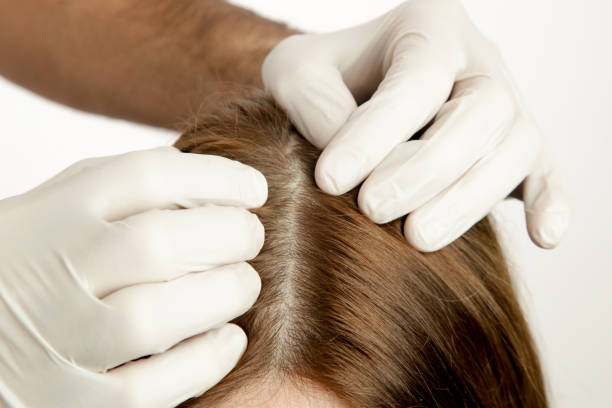 Person with gloved hands examining a person's scalp